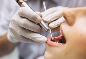 La periodontitis y el COVID19 - Clínica dental en Avilés - Suárez Rivaya