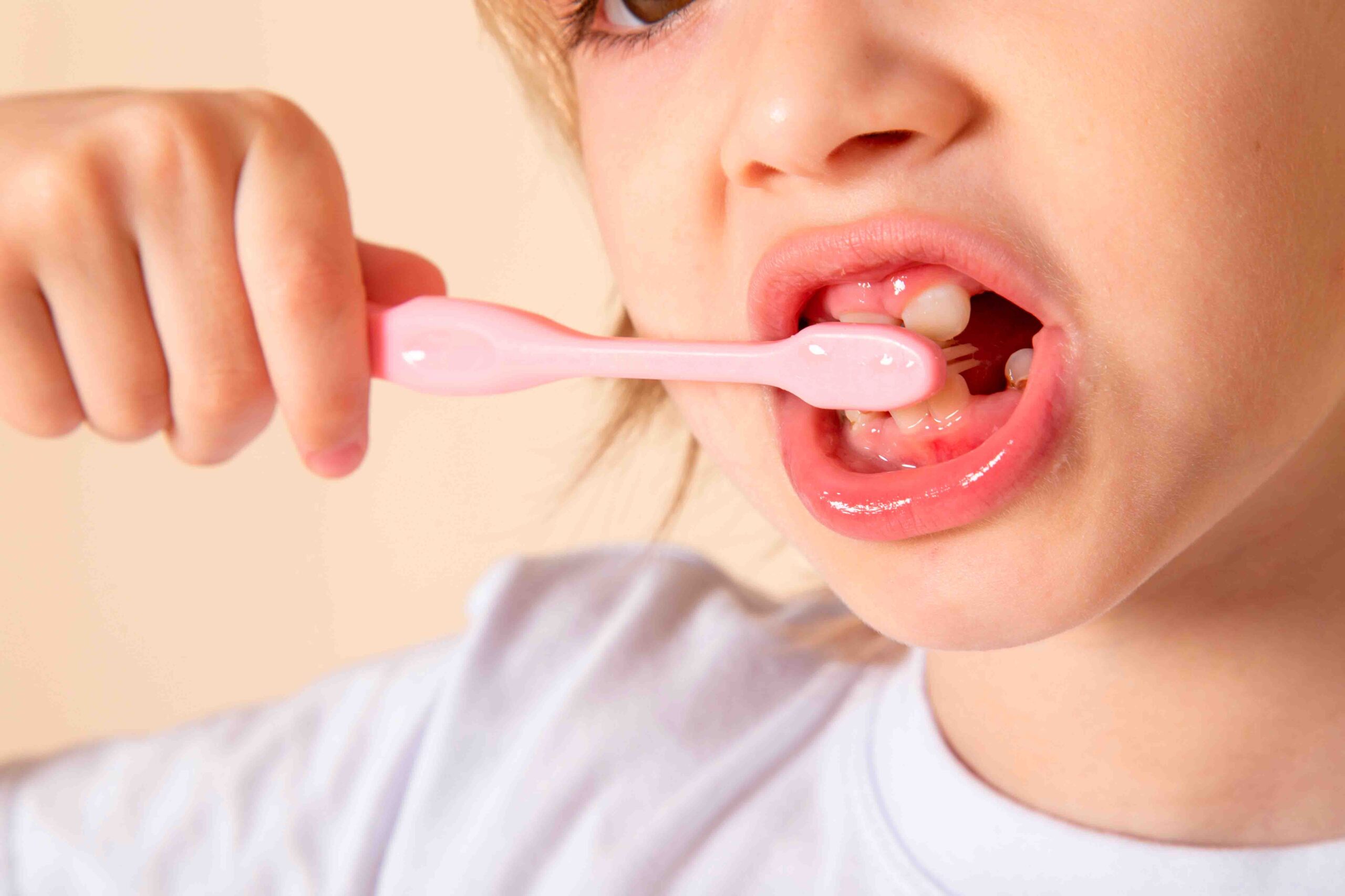 Limpieza dental en niños