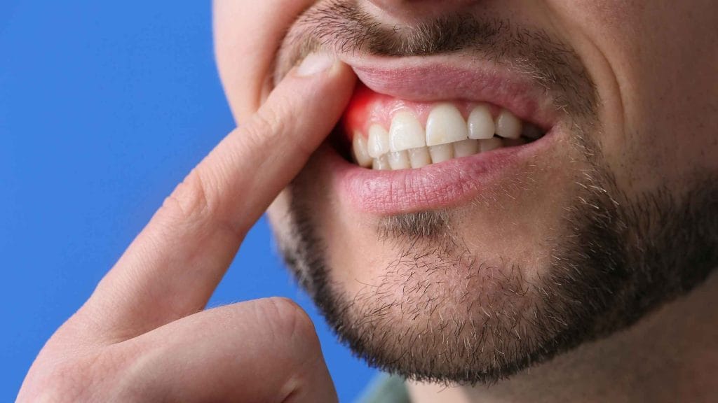 Enfermedades periodontales