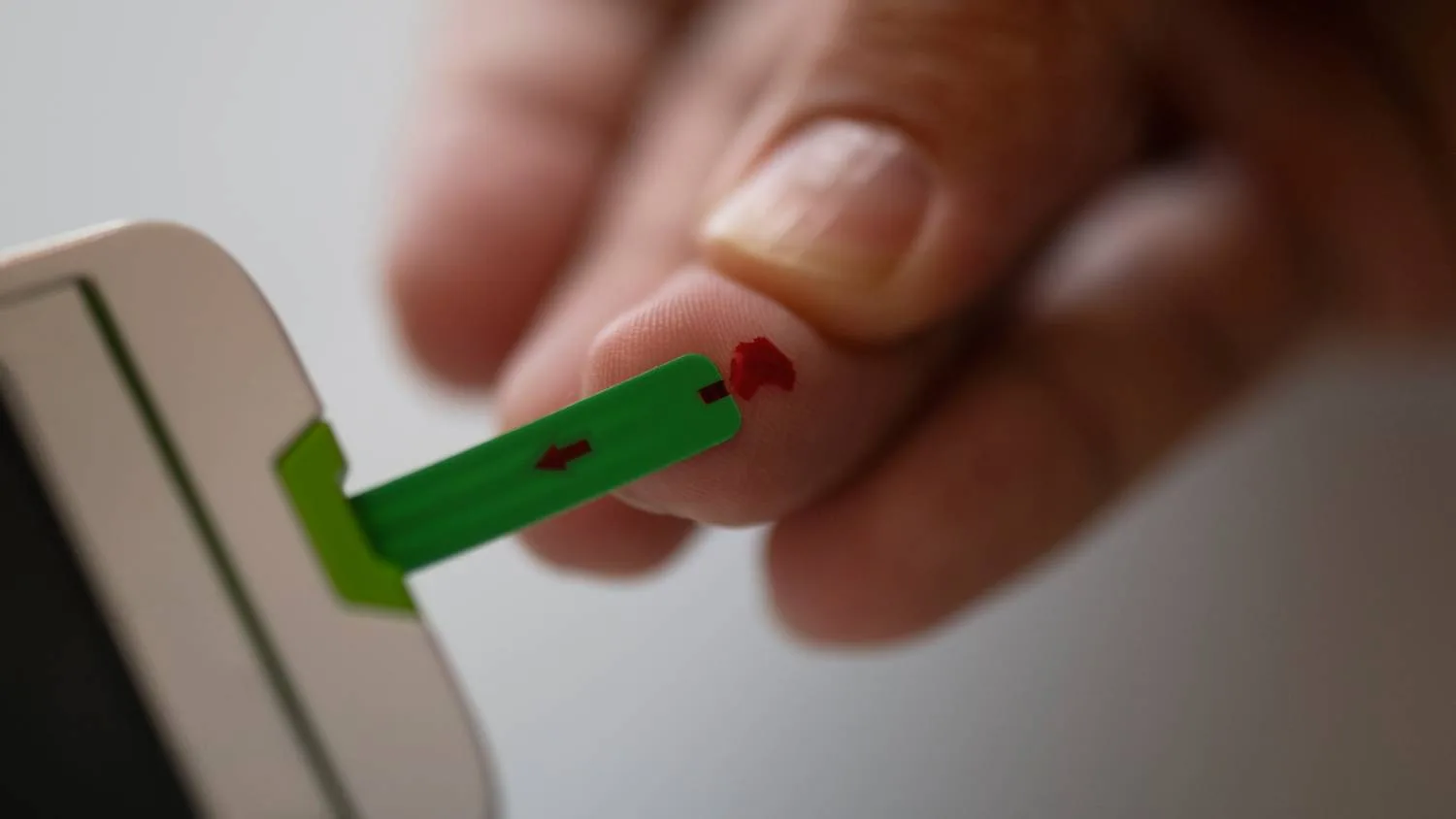 Relación entre la diabetes y la periodoncia