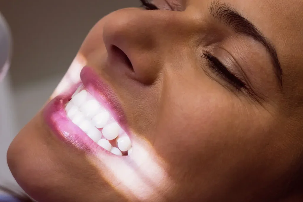 imagen de blanqueamiento dental profesional en clínica