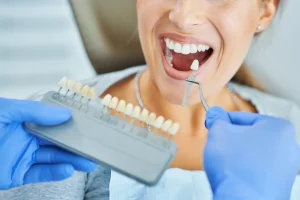 Dentista mostrando colores para ponerse carillas en los dientes